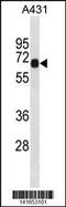 Dynein intermediate chain 2, axonemal antibody, 60-907, ProSci, Western Blot image 