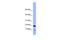 Peptidylprolyl Cis/Trans Isomerase, NIMA-Interacting 4 antibody, GTX45042, GeneTex, Western Blot image 