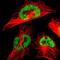 Thyroid Hormone Receptor Associated Protein 3 antibody, NBP1-86915, Novus Biologicals, Immunofluorescence image 