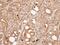 Protein Phosphatase 3 Regulatory Subunit B, Alpha antibody, PA5-28943, Invitrogen Antibodies, Immunohistochemistry frozen image 