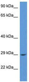 RAB2B, Member RAS Oncogene Family antibody, TA343026, Origene, Western Blot image 