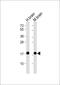 Synuclein Alpha antibody, M00215-4, Boster Biological Technology, Western Blot image 