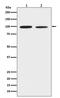 Discoidin Domain Receptor Tyrosine Kinase 2 antibody, M01698, Boster Biological Technology, Western Blot image 