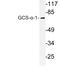 Guanylate Cyclase 1 Soluble Subunit Alpha 1 antibody, LS-B11776, Lifespan Biosciences, Western Blot image 