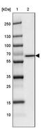 Phosphoglucomutase 5 antibody, PA5-61216, Invitrogen Antibodies, Western Blot image 