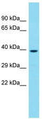 Coiled-Coil Domain Containing 97 antibody, TA333574, Origene, Western Blot image 
