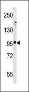 Glutamate Metabotropic Receptor 5 antibody, LS-C100137, Lifespan Biosciences, Western Blot image 