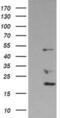 DExD-Box Helicase 39B antibody, MA5-25115, Invitrogen Antibodies, Western Blot image 