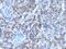 Glypican 3 antibody, GTX34765, GeneTex, Immunohistochemistry paraffin image 