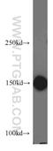 Rho Associated Coiled-Coil Containing Protein Kinase 1 antibody, 21850-1-AP, Proteintech Group, Western Blot image 