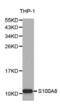 S100 Calcium Binding Protein A8 antibody, abx001416, Abbexa, Western Blot image 