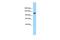 GEM Interacting Protein antibody, PA5-45745, Invitrogen Antibodies, Western Blot image 