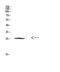 Heat Shock Protein Family B (Small) Member 1 antibody, STJ98669, St John