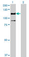 Serine/Threonine Kinase 31 antibody, LS-C139313, Lifespan Biosciences, Western Blot image 