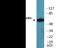 Cortactin antibody, EKC2379, Boster Biological Technology, Western Blot image 