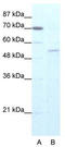 Zinc Finger Protein 665 antibody, TA341397, Origene, Western Blot image 