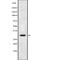 Iodothyronine Deiodinase 3 antibody, abx219196, Abbexa, Western Blot image 