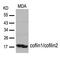 Cofilin 1 antibody, GTX50872, GeneTex, Western Blot image 