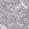 Poly(ADP-Ribose) Polymerase Family Member 10 antibody, NBP1-83689, Novus Biologicals, Immunohistochemistry paraffin image 