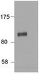 HIC ZBTB Transcriptional Repressor 1 antibody, PA5-37864, Invitrogen Antibodies, Western Blot image 