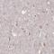 TBC1 Domain Family Member 25 antibody, HPA029197, Atlas Antibodies, Immunohistochemistry paraffin image 