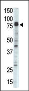 Doublecortin Like Kinase 1 antibody, AP13897PU-N, Origene, Western Blot image 