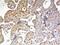 Inhibin Subunit Beta B antibody, NBP2-12010, Novus Biologicals, Immunohistochemistry frozen image 