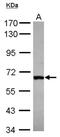 DEAD-Box Helicase 28 antibody, NBP2-16131, Novus Biologicals, Western Blot image 