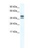 TATA-Box Binding Protein Like 2 antibody, MBS834633, MyBioSource, Western Blot image 