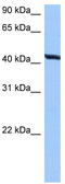 Ring Finger Protein, Transmembrane 2 antibody, TA339630, Origene, Western Blot image 