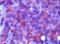 Membrane Metalloendopeptidase antibody, 32-127, ProSci, Immunohistochemistry paraffin image 
