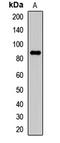 Potassium Voltage-Gated Channel Subfamily A Member 2 antibody, orb412443, Biorbyt, Western Blot image 