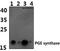 Prostaglandin E Synthase antibody, A02587, Boster Biological Technology, Western Blot image 