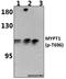 Mbs antibody, A01743T696, Boster Biological Technology, Western Blot image 