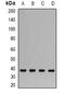 CLN2 antibody, abx142275, Abbexa, Western Blot image 