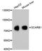 Scavenger Receptor Class B Member 1 antibody, abx125395, Abbexa, Western Blot image 