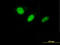 DnaJ Heat Shock Protein Family (Hsp40) Member C7 antibody, LS-C198378, Lifespan Biosciences, Immunofluorescence image 
