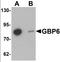 Guanylate Binding Protein Family Member 6 antibody, orb137295, Biorbyt, Western Blot image 