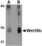 Wnt Family Member 10B antibody, TA306582, Origene, Western Blot image 