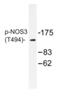 Nitric Oxide Synthase 3 antibody, AP01888PU-N, Origene, Western Blot image 