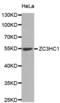 Zinc Finger C3HC-Type Containing 1 antibody, abx004839, Abbexa, Western Blot image 