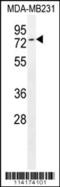 TCDD Inducible Poly(ADP-Ribose) Polymerase antibody, 56-209, ProSci, Western Blot image 