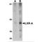 Nuclear Receptor Subfamily 1 Group H Member 3 antibody, MBS150555, MyBioSource, Western Blot image 