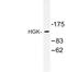 Mitogen-Activated Protein Kinase Kinase Kinase Kinase 4 antibody, LS-C176891, Lifespan Biosciences, Western Blot image 