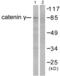 Junction Plakoglobin antibody, abx013030, Abbexa, Western Blot image 