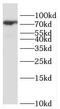 Potassium Voltage-Gated Channel Subfamily J Member 1 antibody, FNab04490, FineTest, Western Blot image 