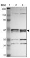 Parvin Alpha antibody, NBP1-87912, Novus Biologicals, Western Blot image 