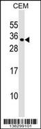 MAX Dimerization Protein 1 antibody, 58-988, ProSci, Western Blot image 