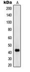 Ribosomal Modification Protein RimK Like Family Member A antibody, MBS820167, MyBioSource, Western Blot image 