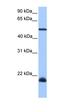 Dyslexia susceptibility 1 candidate gene 1 protein antibody, orb330689, Biorbyt, Western Blot image 